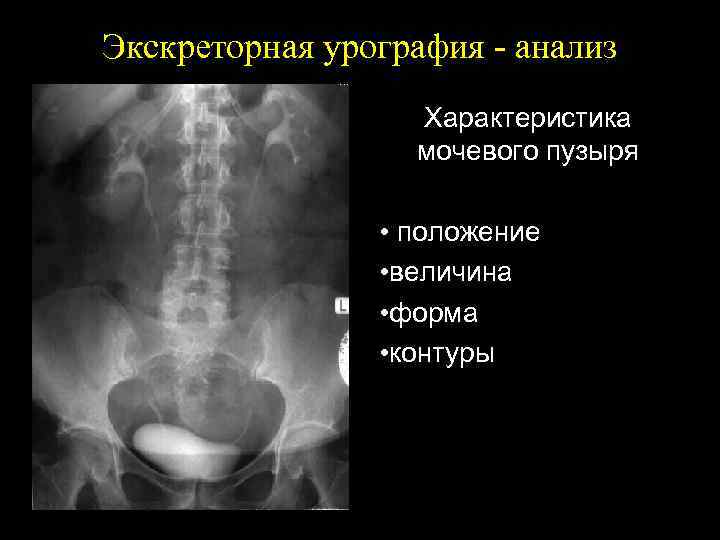 Урография как проводится