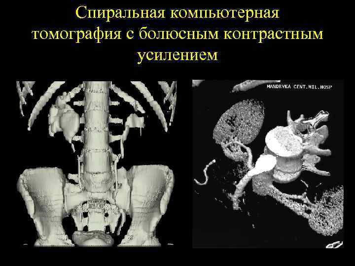 Схема компьютерная томография