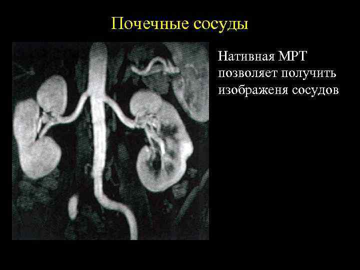 Лучевая диагностика почек презентация