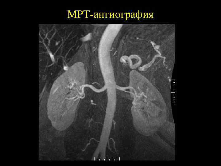 МРТ-ангиография 