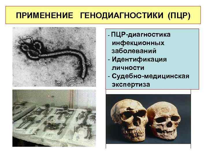 ПРИМЕНЕНИЕ ГЕНОДИАГНОСТИКИ (ПЦР) - ПЦР-диагностика инфекционных заболеваний - Идентификация личности - Судебно-медицинская экспертиза 