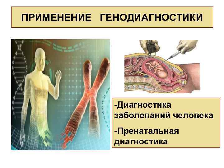 ПРИМЕНЕНИЕ ГЕНОДИАГНОСТИКИ -Диагностика заболеваний человека -Пренатальная диагностика 