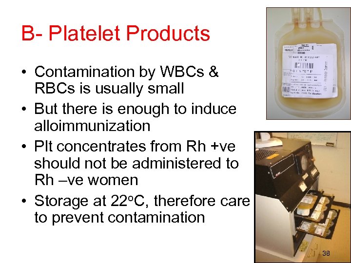 B- Platelet Products • Contamination by WBCs & RBCs is usually small • But