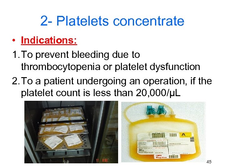 2 - Platelets concentrate • Indications: 1. To prevent bleeding due to thrombocytopenia or