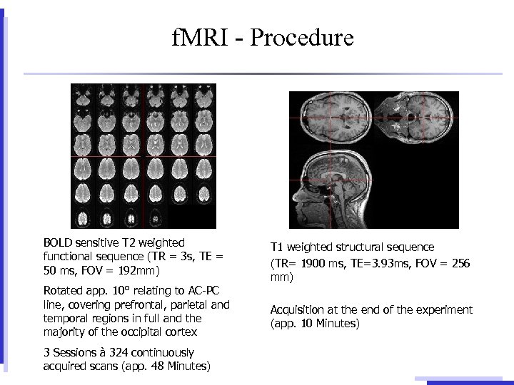 f. MRI - Procedure BOLD sensitive T 2 weighted functional sequence (TR = 3