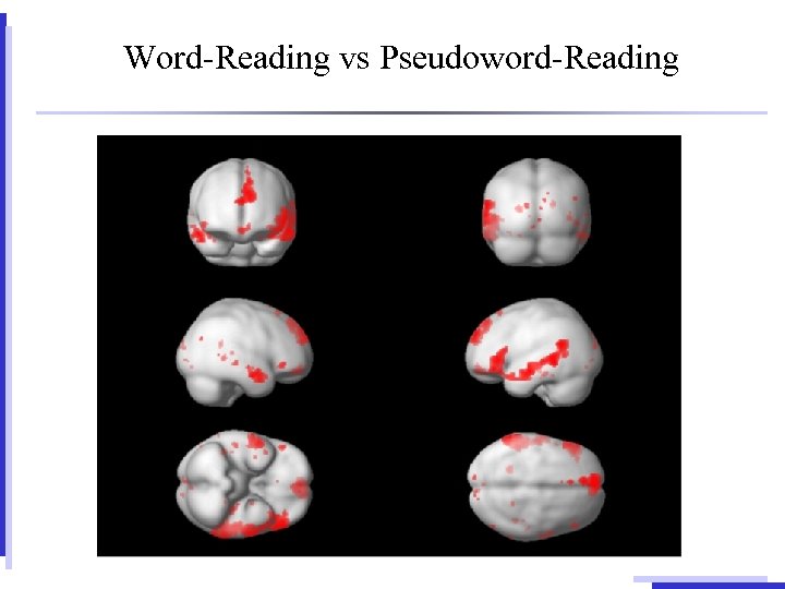 Word-Reading vs Pseudoword-Reading 