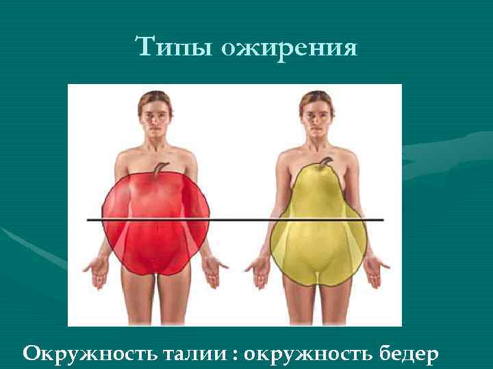 Ожирение окружность талии. Типы ожирения. Смешанный Тип ожирения. Женский Тип ожирения.