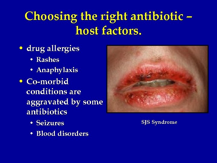 Choosing the right antibiotic – host factors. • drug allergies • Rashes • Anaphylaxis