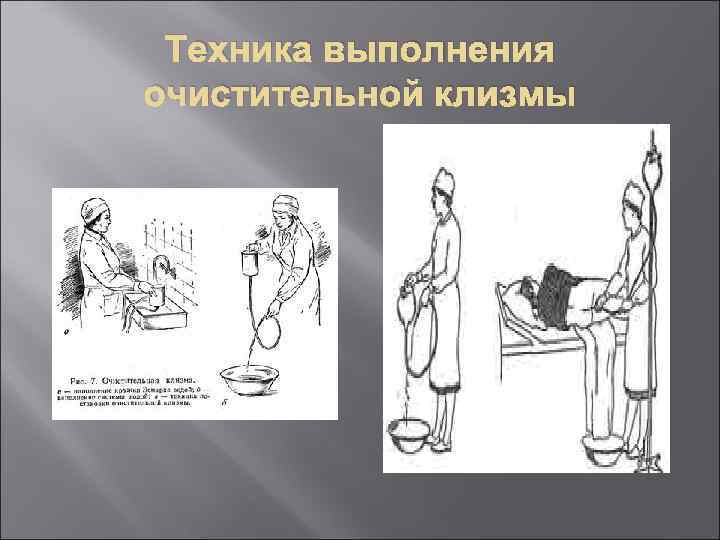 Техника выполнения очистительной клизмы 