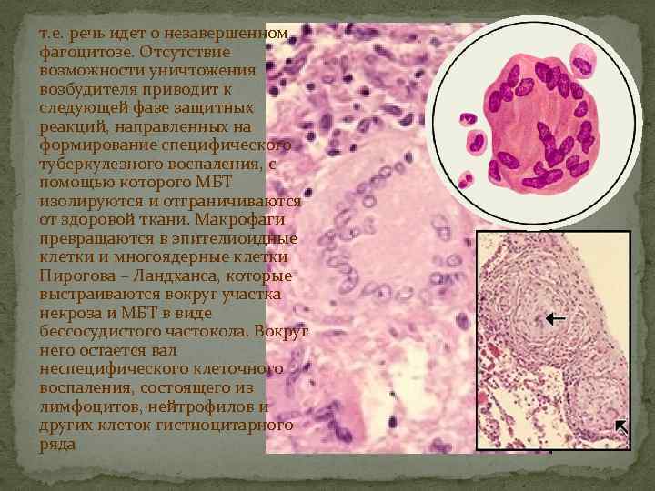 т. е. речь идет о незавершенном фагоцитозе. Отсутствие возможности уничтожения возбудителя приводит к следующей