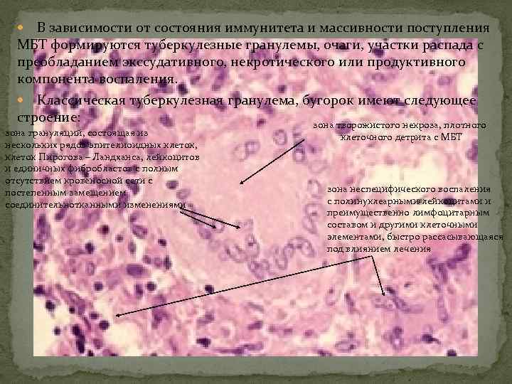 В зависимости от состояния иммунитета и массивности поступления МБТ формируются туберкулезные гранулемы, очаги, участки