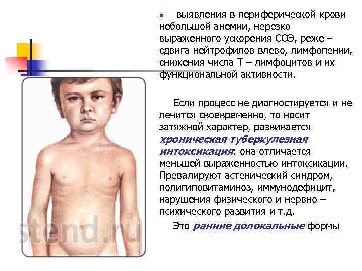  выявления в периферической крови небольшой анемии, нерезко выраженного ускорения СОЭ, реже – сдвига