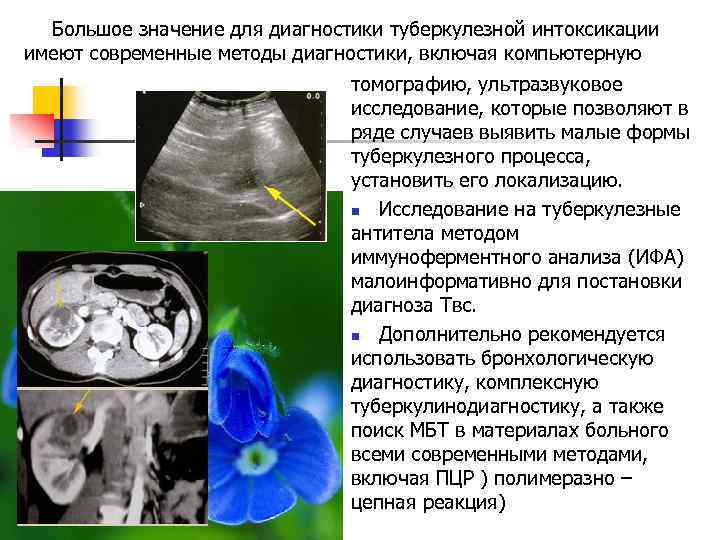 Большое значение для диагностики туберкулезной интоксикации имеют современные методы диагностики, включая компьютерную томографию, ультразвуковое