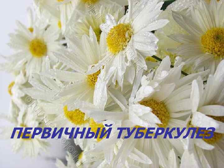 ПЕРВИЧНЫЙ ТУБЕРКУЛЕЗ 
