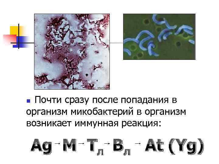  Почти сразу после попадания в организм микобактерий в организм возникает иммунная реакция: n