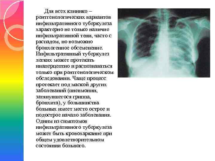 Для всех клинико – рентгенологических вариантов инфильтративного туберкулеза характерно не только наличие инфильтративной тени,