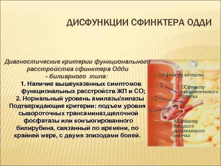 ДИСФУНКЦИИ СФИНКТЕРА ОДДИ Диагностические критерии функционального расстройства сфинктера Одди - билиарного типа: 1. Наличие
