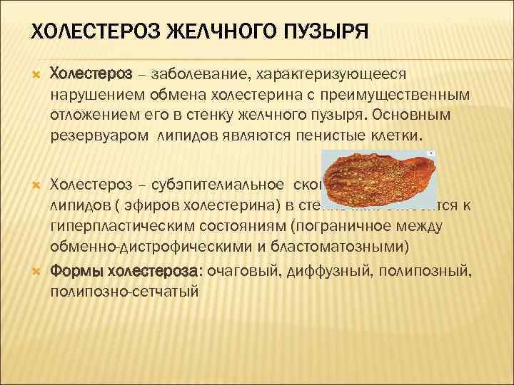 ХОЛЕСТЕРОЗ ЖЕЛЧНОГО ПУЗЫРЯ Холестероз – заболевание, характеризующееся нарушением обмена холестерина с преимущественным отложением его