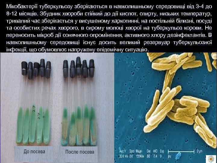 Мікобактерії туберкульозу зберігаються в навколишньому середовищі від 3 -4 до 8 -12 місяців. Збудник