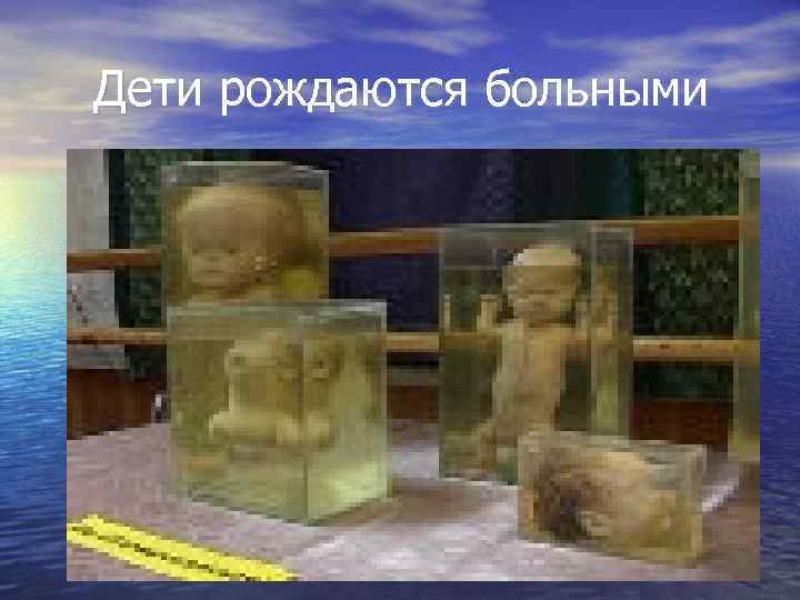 Дети рождаются больными 