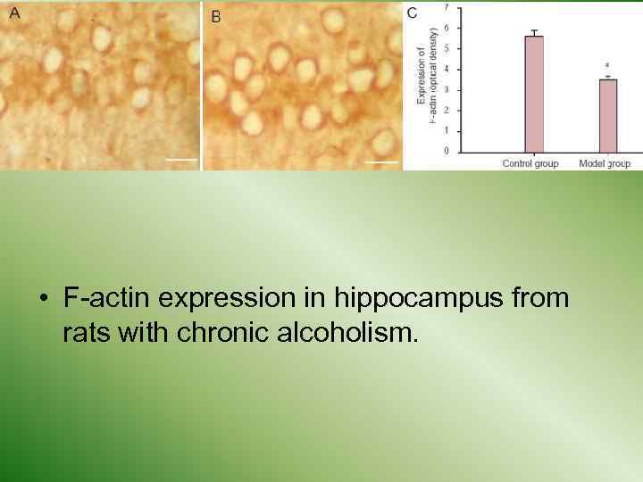  • F-actin expression in hippocampus from rats with chronic alcoholism. 