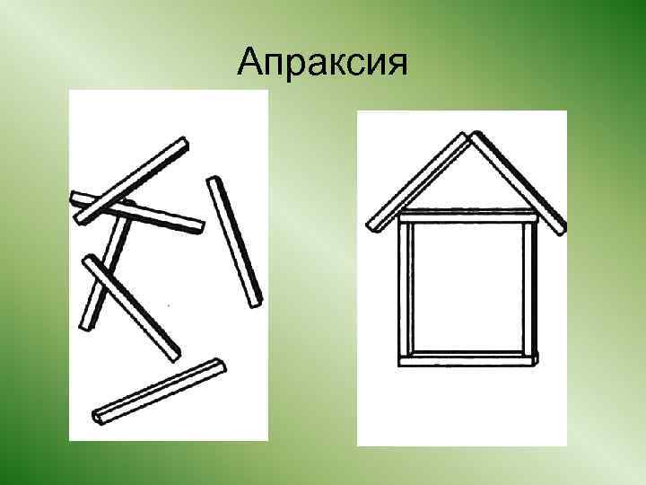 Артикуляционная апраксия презентация