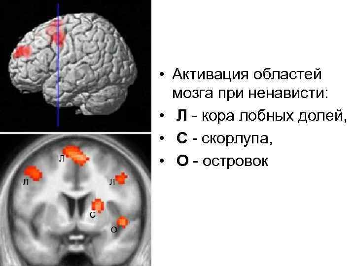  • Активация областей мозга при ненависти: • Л - кора лобных долей, •