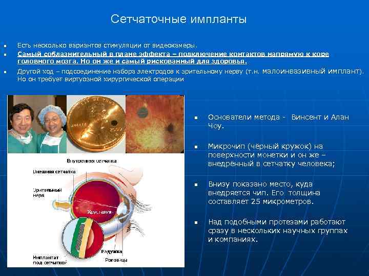 Сетчаточные импланты n n n Есть несколько вариантов стимуляции от видеокамеры. Самый соблазнительный в