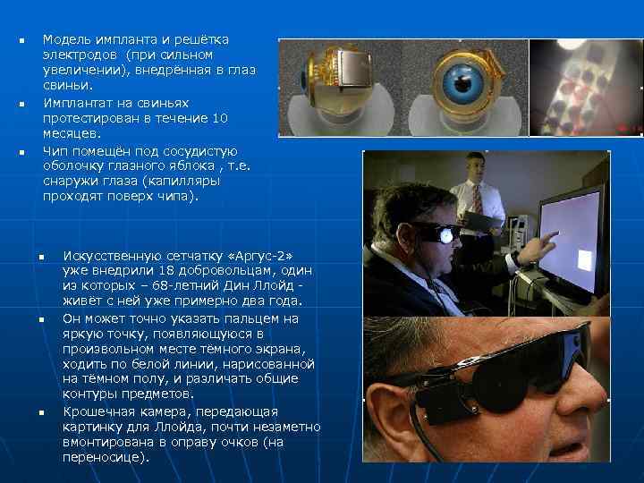 n n n Модель импланта и решётка электродов (при сильном увеличении), внедрённая в глаз