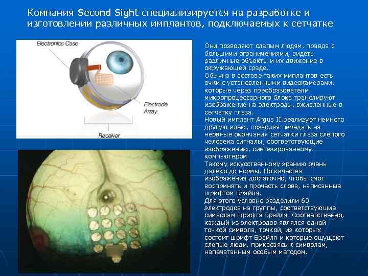 Компания Second Sight специализируется на разработке и изготовлении различных имплантов, подключаемых к сетчатке Они