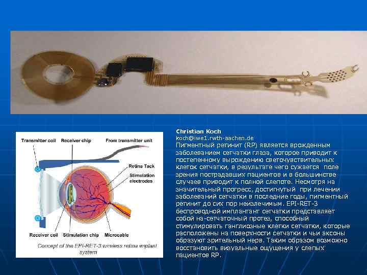Christian Koch koch@iwe 1. rwth-aachen. de Пигментный ретинит (RP) является врожденным заболеванием сетчатки глаза,
