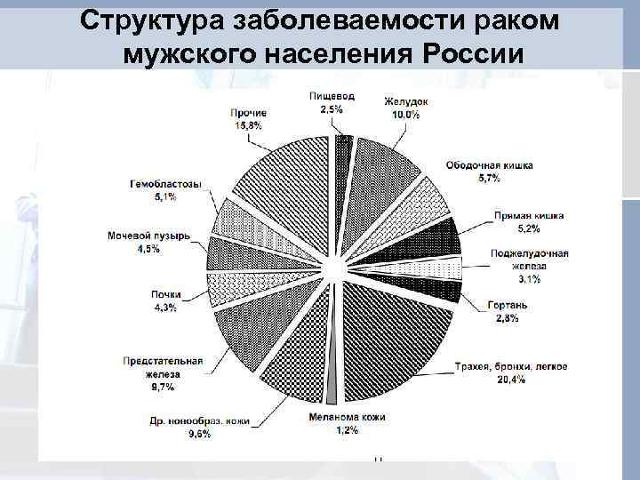 Структура заболеваемости раком мужского населения России z 