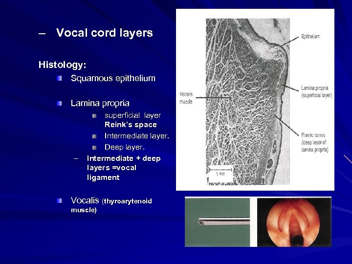 – Vocal cord layers Histology: Squamous epithelium Lamina propria – superficial layer Reink’s space