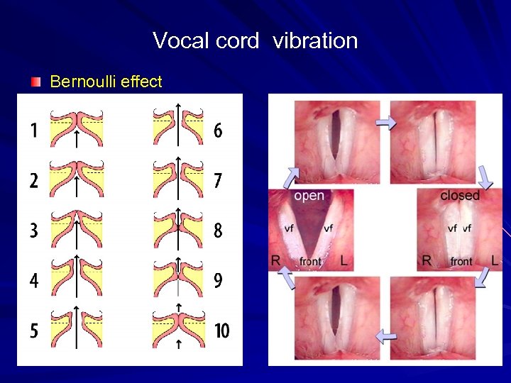 Vocal cord vibration Bernoulli effect 