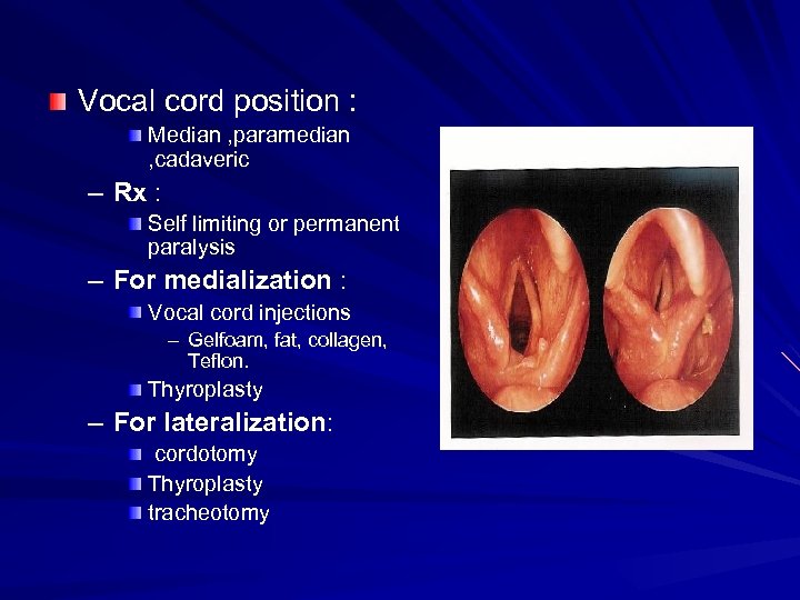 Vocal cord position : Median , paramedian , cadaveric – Rx : Self limiting