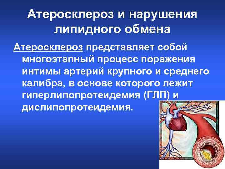 Атеросклероз и нарушения липидного обмена Атеросклероз представляет собой многоэтапный процесс поражения интимы артерий крупного