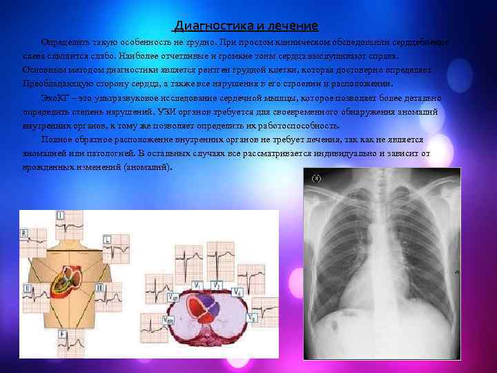 Диагностика и лечение Определить такую особенность не трудно. При простом клиническом обследовании сердцебиение слева
