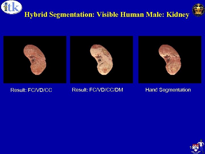 Hybrid Segmentation: Visible Human Male: Kidney Result: FC/VD/CC Columbia University Result: FC/VD/CC/DM Hand Segmentation