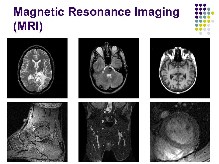 Magnetic Resonance Imaging (MRI) 4 