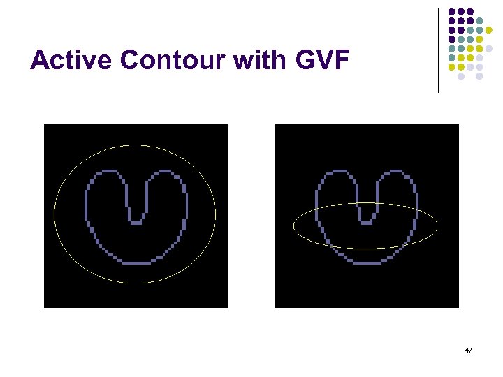 Active Contour with GVF 47 