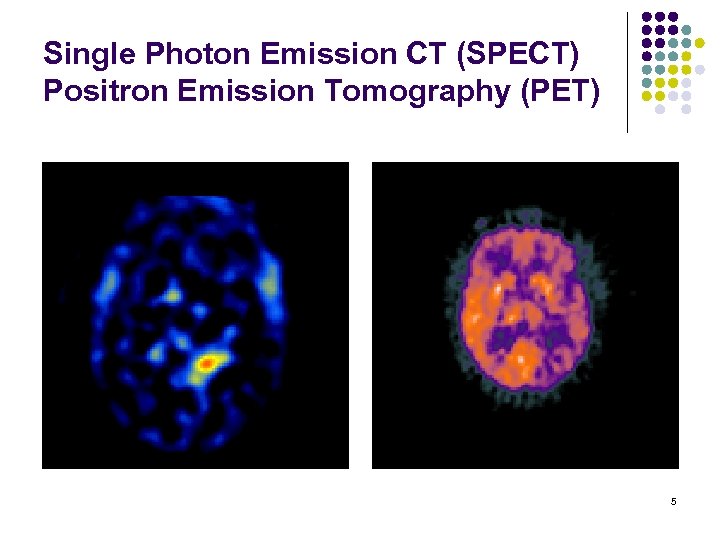 Single Photon Emission CT (SPECT) Positron Emission Tomography (PET) 5 