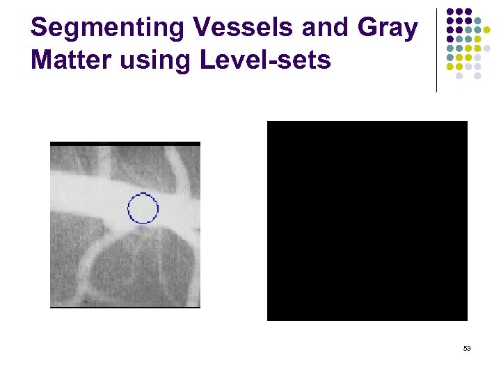 Segmenting Vessels and Gray Matter using Level-sets 53 