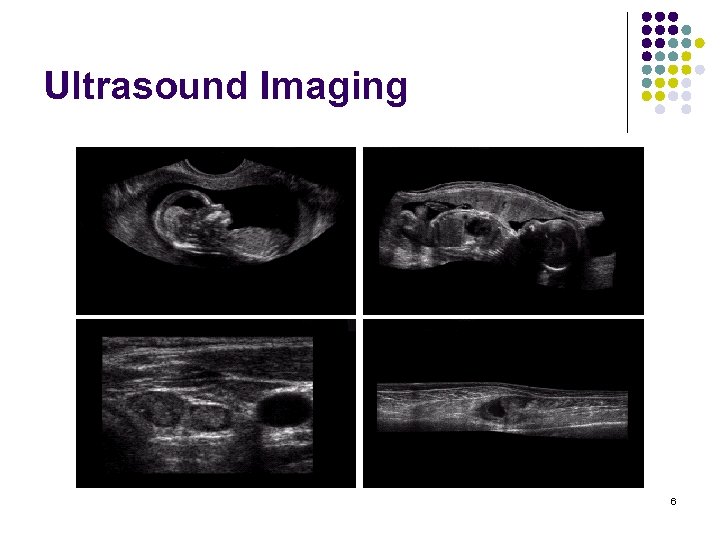 Ultrasound Imaging 6 