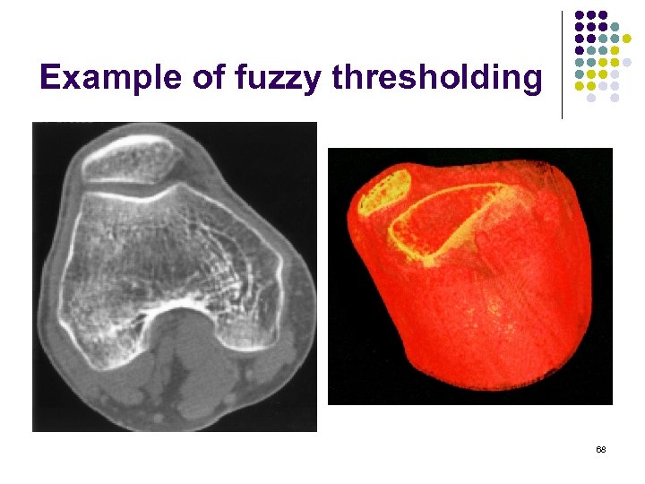 Example of fuzzy thresholding 68 