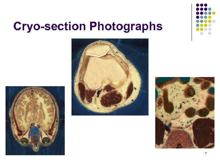 Cryo-section Photographs 7 