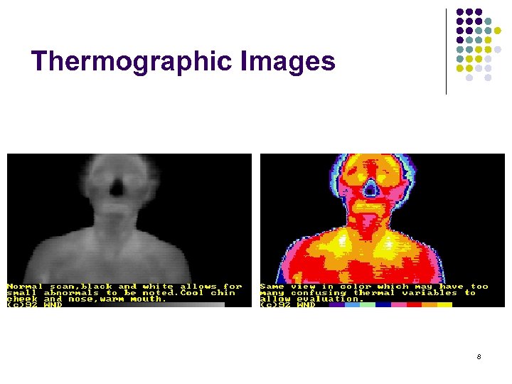 Thermographic Images 8 