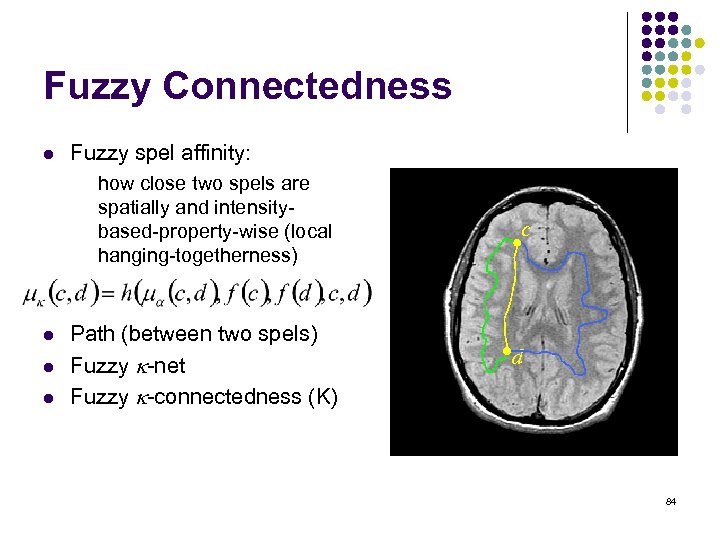 Fuzzy Connectedness l Fuzzy spel affinity: how close two spels are spatially and intensitybased-property-wise