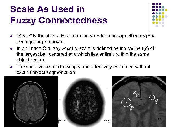 Scale As Used in Fuzzy Connectedness l l l “Scale” is the size of