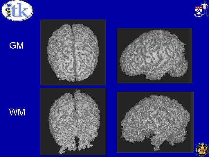 Method I: Gray Matter GM WM ________________________ Understanding Visual Information: Technical, Cognitive and Social