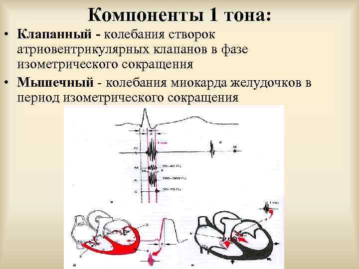 Компоненты 1 тона: • Клапанный - колебания створок атриовентрикулярных клапанов в фазе изометрического сокращения